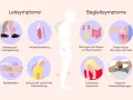 Illustration von Parkinson-Symptomen: Bewegungsverlangsamung, Muskelversteifung, Zittern, Haltungsstörung, Blasen-/Darmprobleme, Hautempfindungsstörungen, psychische und kognitive Probleme.