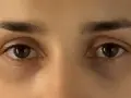 Nahaufnahme von Augen mit dunklen Ringen unter den Augen.