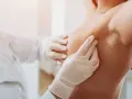 Arzt in Handschuhen tastet Brust ab.