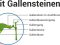 Verstopfte Gallengänge: Symptome erkennen & Ursachen verstehen