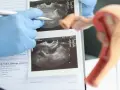 Ultraschall Frauenarzt: Kassenleistung oder IGeL? Wann sinnvoll?