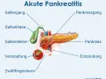 Chronische Pankreatitis: Diagnose-Schritte & Symptome erklärt