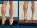 Wadenheben zur Linderung von Achillodynie-Symptomen. Die Übung zeigt die Anspannung der Wadenmuskulatur.