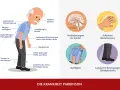 Illustration von Parkinson-Symptomen: gebeugte Haltung, Tremor, Steifigkeit, Gehirn.