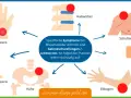 Rheumatoide Arthritis: Diagnose-Schritte & frühe Anzeichen erkennen