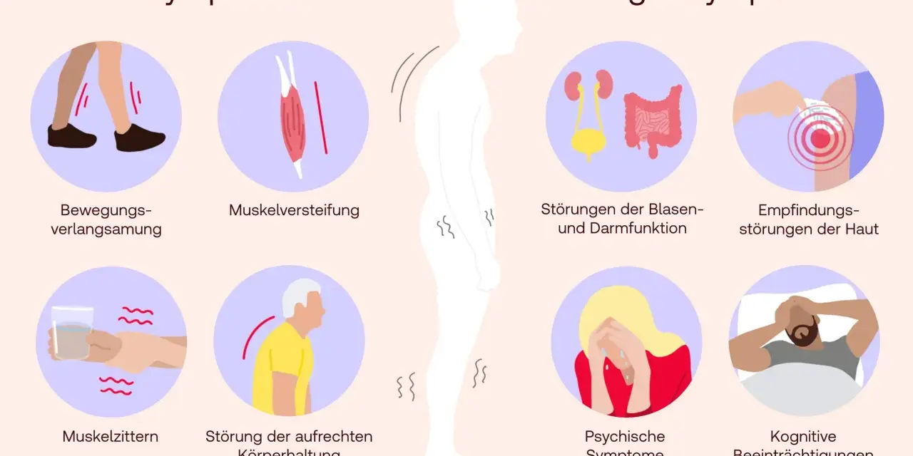 Illustration von Parkinson-Symptomen: Bewegungsverlangsamung, Muskelversteifung, Zittern, Haltungsstörung, Blasen-/Darmprobleme, Hautempfindungsstörungen, psychische und kognitive Probleme.