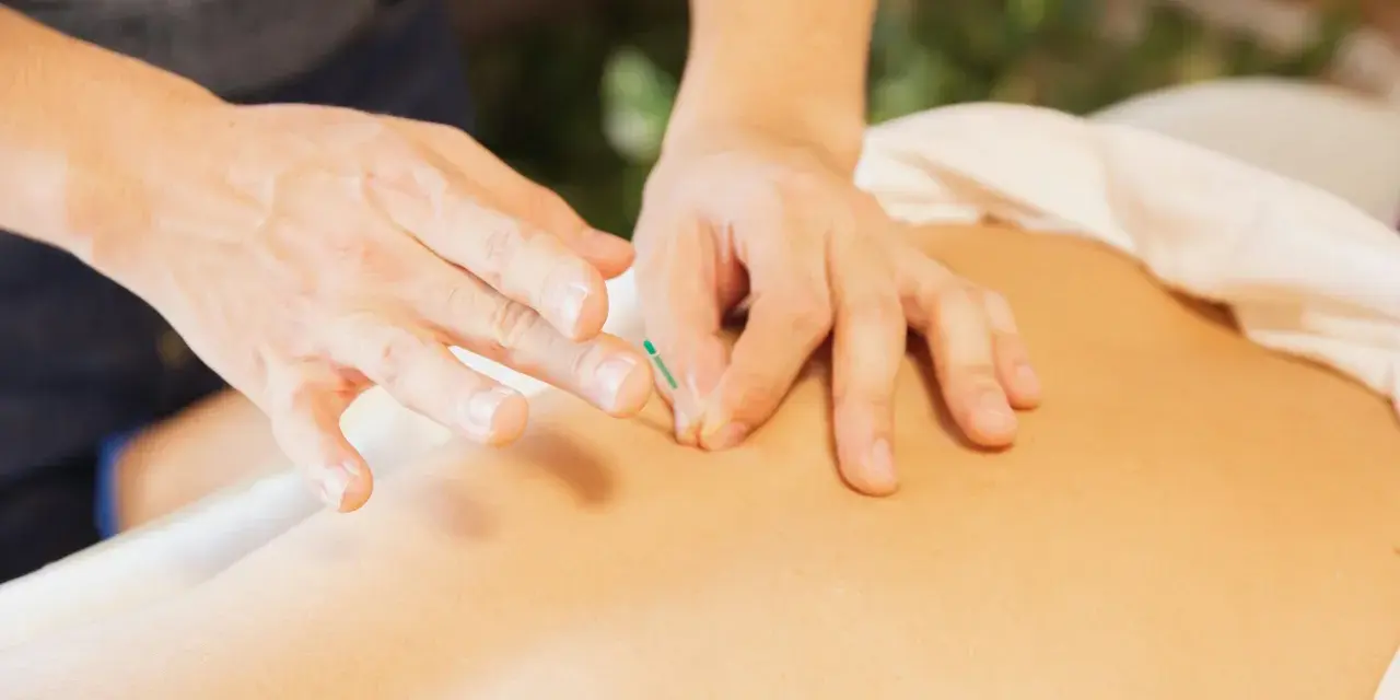 Ein Physiotherapeut setzt eine Akupunkturnadel. Dies ist eine Behandlungsmethode, die auch von Physiotherapeuten angewendet werden darf.