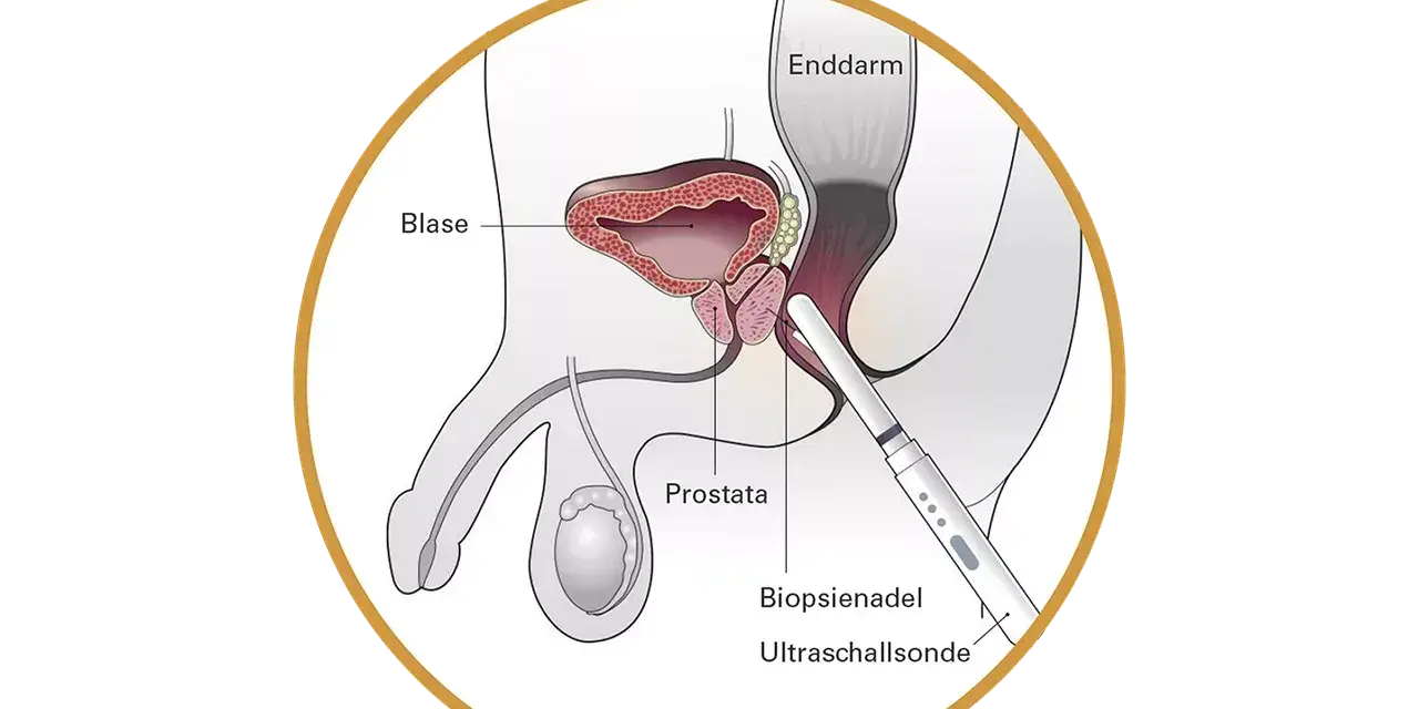 Prostata-Vorsorge ab 30: Wann ist sie wirklich nötig?