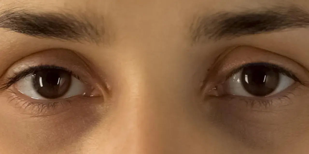 Nahaufnahme von Augen mit dunklen Ringen unter den Augen.