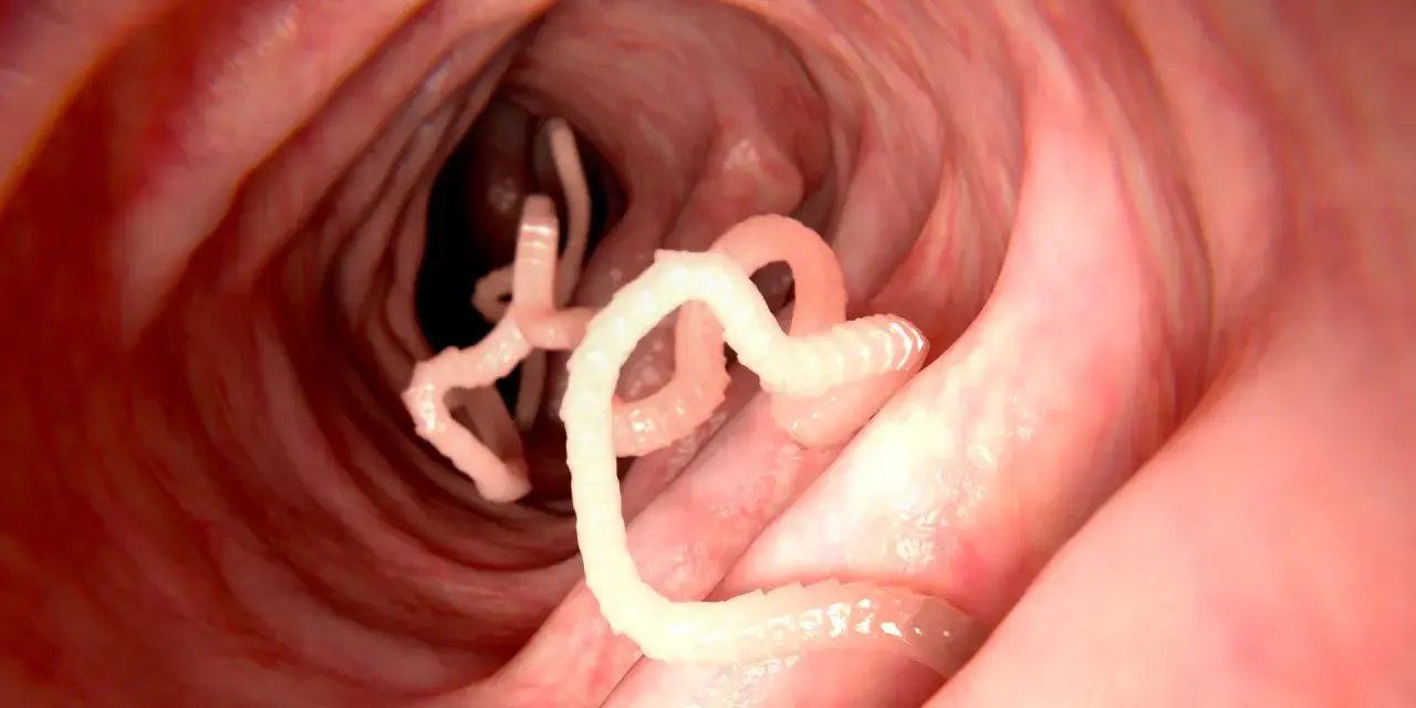 Würmer im Darm: Nahaufnahme von Parasiten, die sich in einem roten, schleimigen Darmwinden.