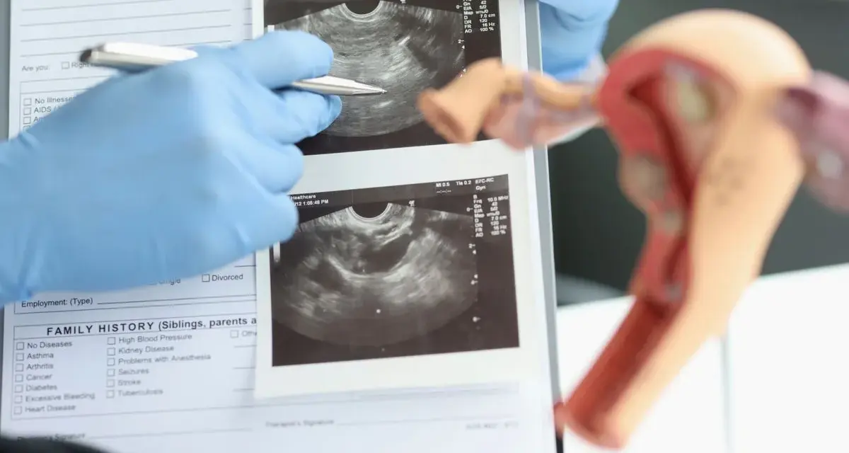 Ultraschall Frauenarzt: Kassenleistung oder IGeL? Wann sinnvoll?