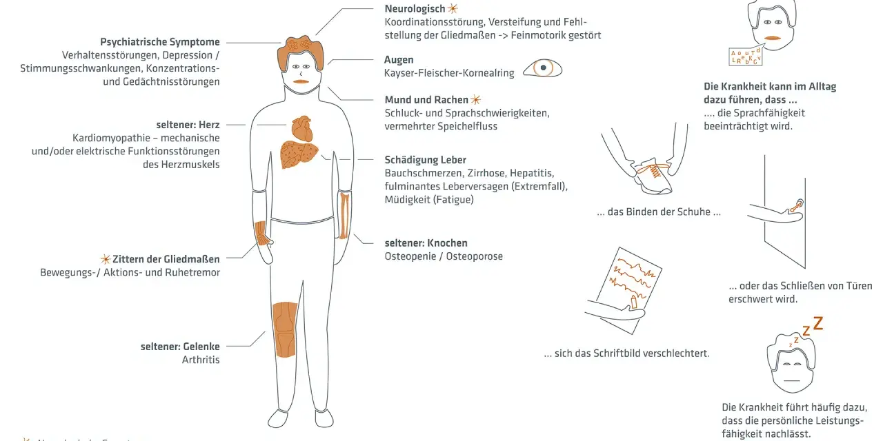 Morbus Wilson Diagnose: Schritte, Tests & Symptome erklärt
