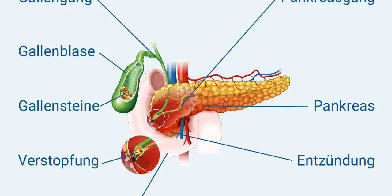 Chronische Pankreatitis: Diagnose-Schritte & Symptome erklärt