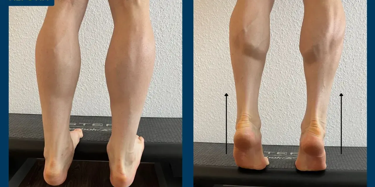 Wadenheben zur Linderung von Achillodynie-Symptomen. Die Übung zeigt die Anspannung der Wadenmuskulatur.