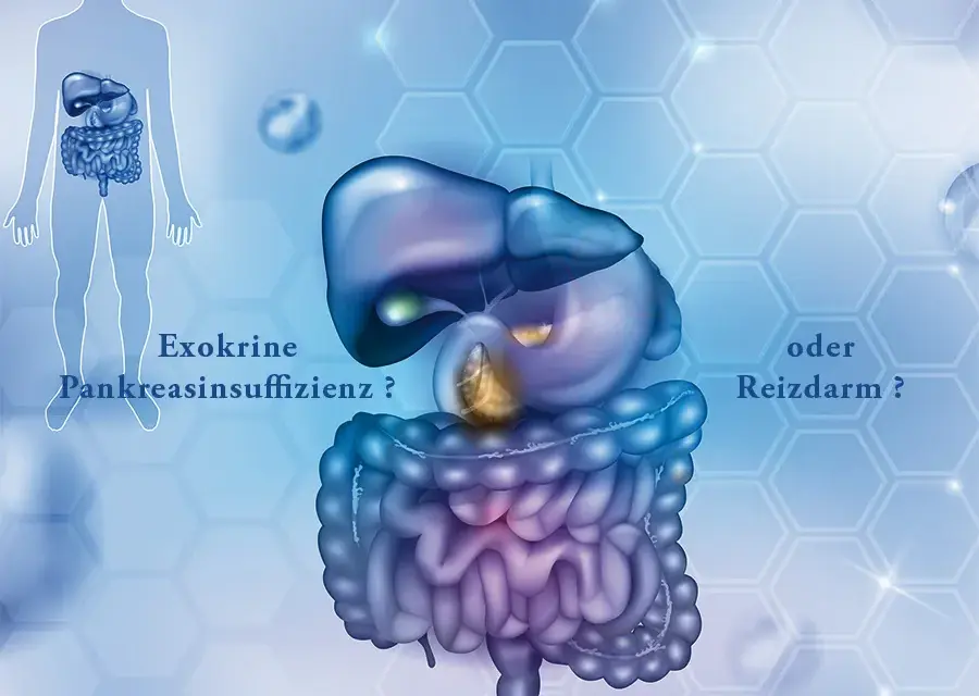 EPI Diagnose: Symptome, Tests & Ihr Weg zur Besserung