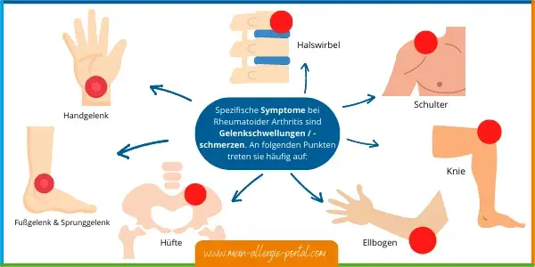 Rheumatoide Arthritis: Diagnose-Schritte & frühe Anzeichen erkennen