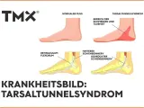 Vergleich Fuß: Normal vs. Tarsaltunnelsyndrom. Ursachen: Nervenkompression im Tarsaltunnel.