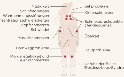 Fibromyalgie symptome: Müdigkeit, Schlafstörungen, Kopfschmerzen, Muskelschmerzen, Übelkeit, Hautprobleme, Sehprobleme, Kiefer- und Gelenkschmerzen, Konzentrationsschwierigkeiten, Schwindel, Harnwegsprobleme, Morgensteifigkeit, Unruhe der Beine.