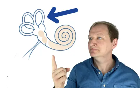 Mann zeigt auf schematische Darstellung des Innenohrs mit Pfeil.