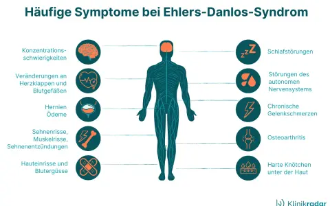 Ehlers-Danlos-Syndrom Diagnose: Ihr Wegweiser