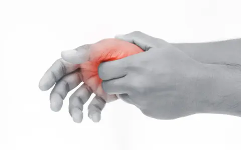 Hand mit roter Markierung am Daumenballen innen, die auf Schmerzen hindeutet.