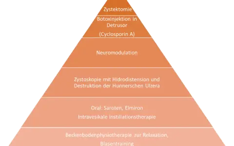 Abstrakte Pyramide mit Behandlungsmethoden für interstitielle Zystitis.