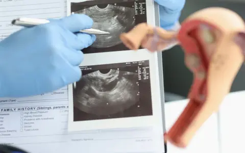 Ultraschall Frauenarzt: Kassenleistung oder IGeL? Wann sinnvoll?