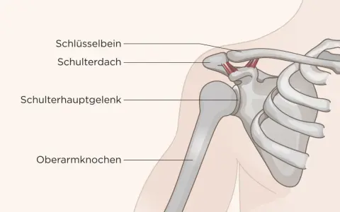 Anatomie der Schulter: Schlüsselbein, Schulterdach, Schulterhauptgelenk und Oberarmknochen. Die Heilung des Schulter-Arm-Syndroms kann variieren.