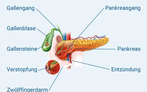 Chronische Pankreatitis: Diagnose-Schritte & Symptome erklärt