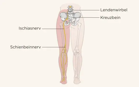 Illustration zeigt den Ischiasnerv, der vom Lendenwirbelbereich über das Kreuzbein bis ins Bein verläuft. Eine Massage kann hier Linderung verschaffen.