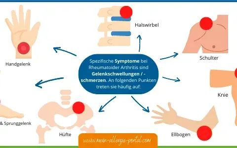 Rheumatoide Arthritis: Diagnose-Schritte & frühe Anzeichen erkennen