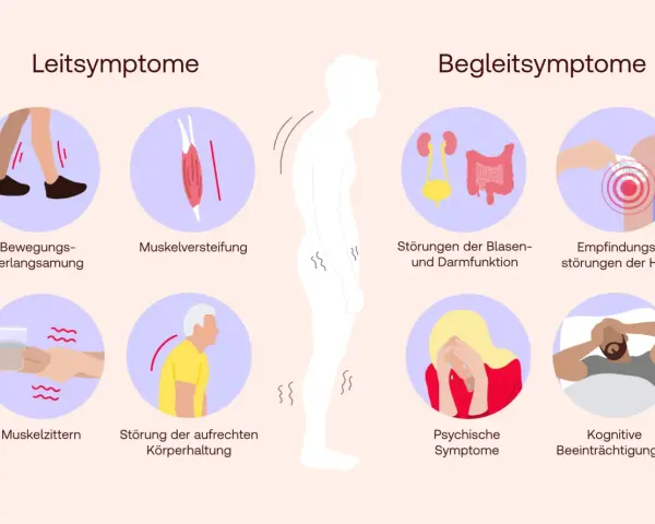 Illustration von Parkinson-Symptomen: Bewegungsverlangsamung, Muskelversteifung, Zittern, Haltungsstörung, Blasen-/Darmprobleme, Hautempfindungsstörungen, psychische und kognitive Probleme.
