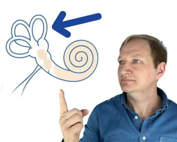 Mann zeigt auf schematische Darstellung des Innenohrs mit Pfeil.