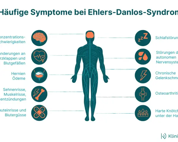 Ehlers-Danlos-Syndrom Diagnose: Ihr Wegweiser