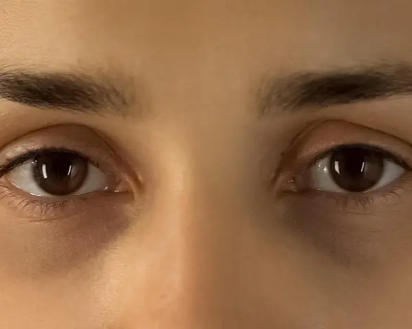 Nahaufnahme von Augen mit dunklen Ringen unter den Augen.