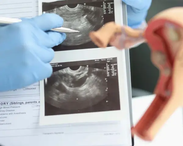 Ultraschall Frauenarzt: Kassenleistung oder IGeL? Wann sinnvoll?
