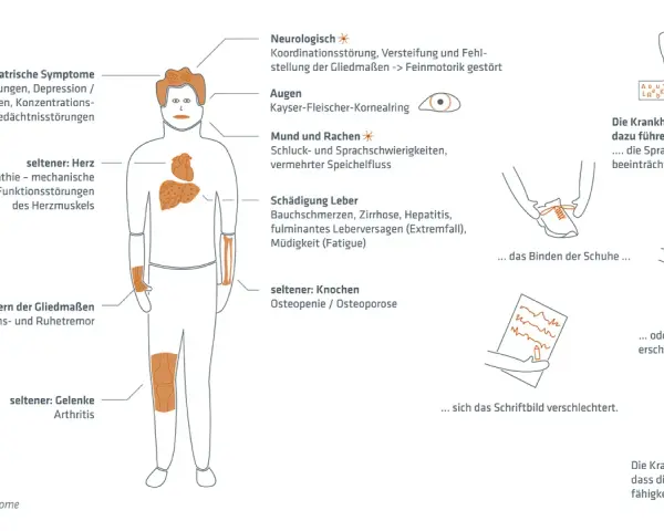 Morbus Wilson Diagnose: Schritte, Tests & Symptome erklärt
