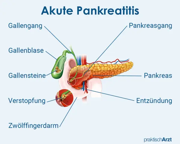 Chronische Pankreatitis: Diagnose-Schritte & Symptome erklärt