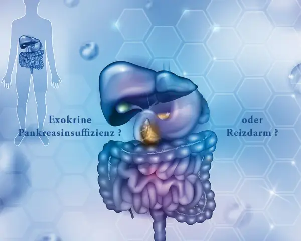 EPI Diagnose: Symptome, Tests & Ihr Weg zur Besserung