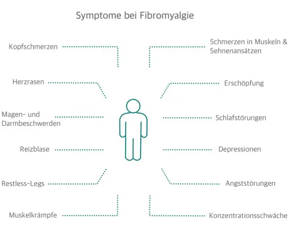 Schema mit menschlicher Figur und umgebenden Symptomen von Fibromyalgie wie Kopfschmerzen, Erschöpfung.