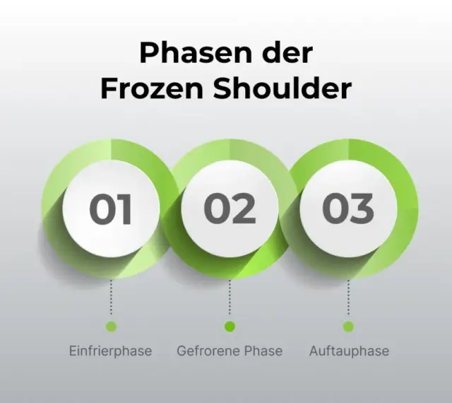 Die drei Phasen der Frozen Shoulder: Einfrierphase, Gefrorene Phase und Auftauphase.