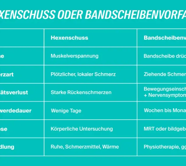 Vergleichstabelle: Ursachen, Schmerzart, Dauer und Behandlung von Hexenschuss und Bandscheibenvorfall.