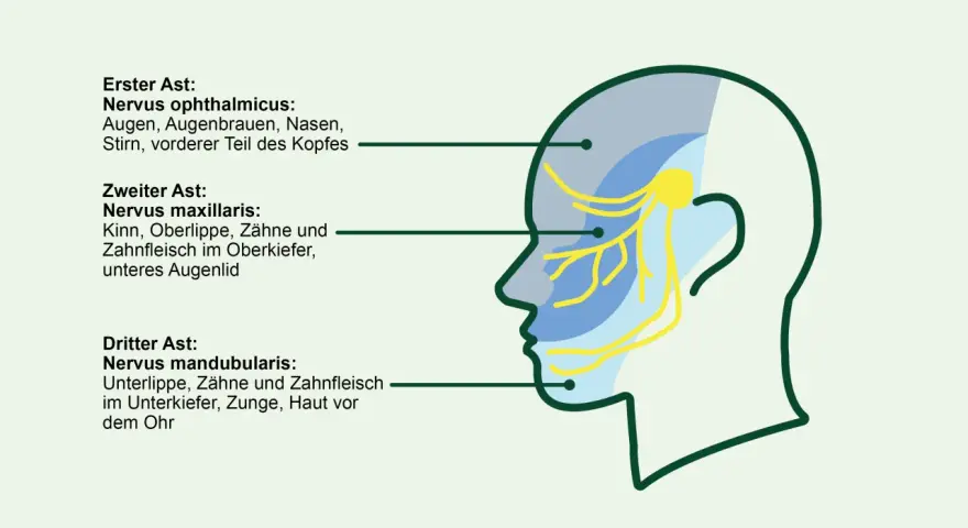 Schema des Trigeminusnervs mit seinen drei Ästen, die verschiedene Gesichtsbereiche versorgen. Eine sanfte Massage kann hier Linderung verschaffen.