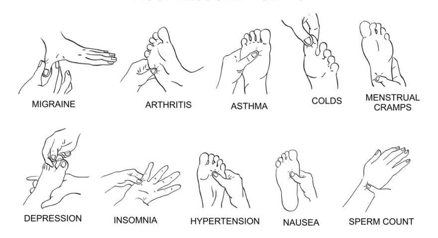 Illustration zeigt akupressur druckpunkte für Migräne, Arthritis, Asthma, Erkältungen, Menstruationsbeschwerden, Depressionen, Schlaflosigkeit, Bluthochdruck, Übelkeit und Spermienzahl.