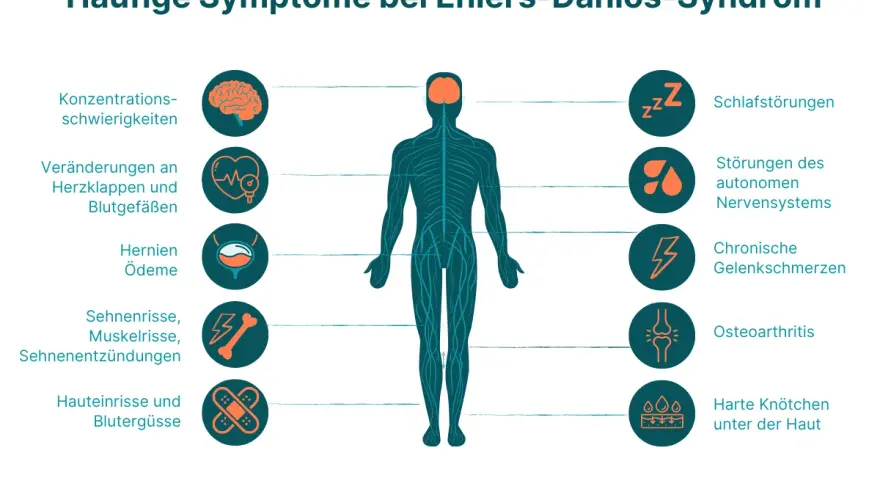 Ehlers-Danlos-Syndrom Diagnose: Ihr Wegweiser