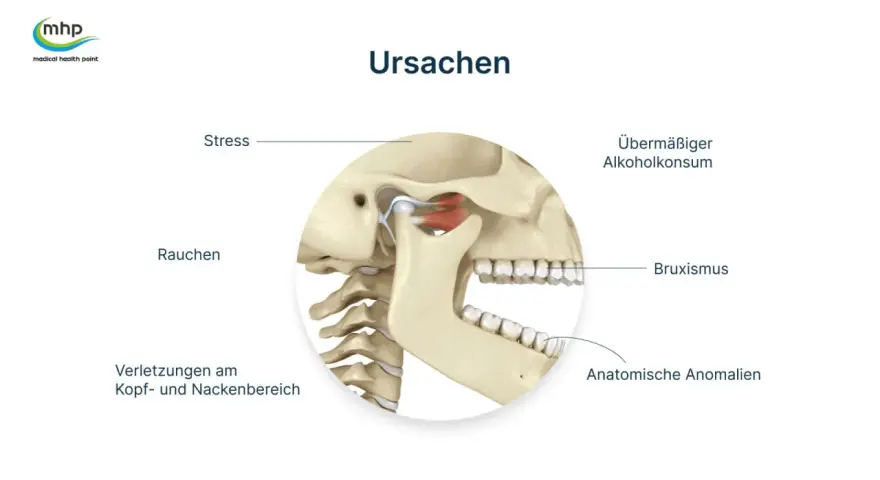 Kiefergelenk: Ursachen wie Stress, Rauchen, Bruxismus, Verletzungen, übermäßiger Alkoholkonsum und anatomische Anomalien. Physiotherapie Kiefergelenk was wird gemacht?