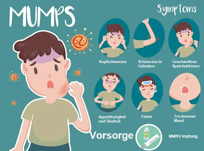 Mumps Symptome Ohrspeicheldrüsenschwellung