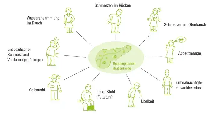 Bauchspeicheldrüse Schema Risikofaktoren