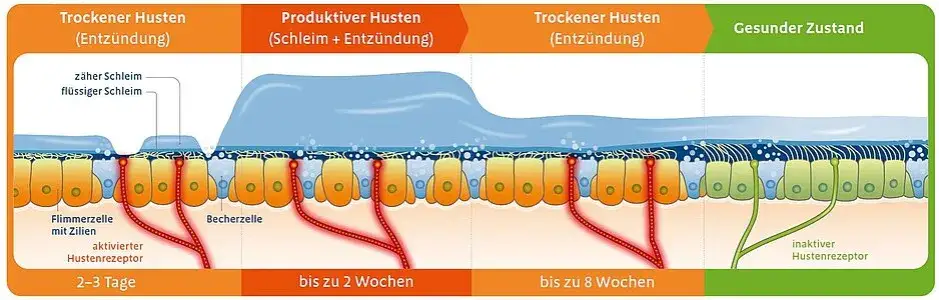 Unterschied trockener und produktiver Husten Illustration