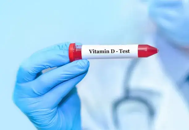 Arzt hält Blutröhrchen mit Vitamin D Test